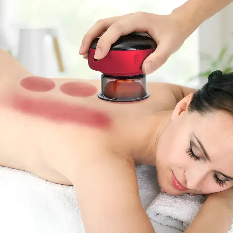Ventosa eléctrica alivio para dolores anti-celulitis con masaje y vibracion